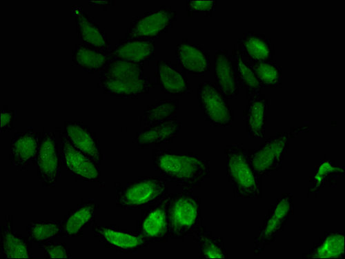 NPL / C112 Antibody - Immunofluorescent analysis of Hela cells using CSB-PA874803LA01HU at a dilution of 1:100 and Alexa Fluor 488-congugated AffiniPure Goat Anti-Rabbit IgG(H+L)