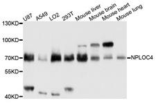 NPLOC4 Antibody - Western blot analysis of extracts of mouse kidney cells.