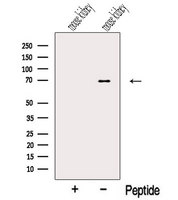NPLOC4 Antibody - Western blot analysis of extracts of mouse kidney tissue using NPLOC4 antibody. The lane on the left was treated with blocking peptide.