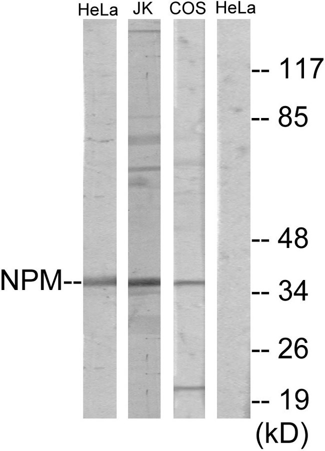 NPM1 / NPM / Nucleophosmin Antibody - Western blot analysis of lysates from HeLa, Jurkat, and COS7 cells, using NPM Antibody. The lane on the right is blocked with the synthesized peptide.