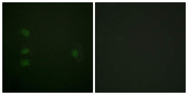 NPM1 / NPM / Nucleophosmin Antibody - Immunofluorescence analysis of HepG2 cells, using NPM Antibody. The picture on the right is blocked with the synthesized peptide.