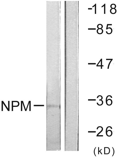 NPM1 / NPM / Nucleophosmin Antibody - Western blot analysis of lysates from Jurkat cells, using NPM Antibody. The lane on the right is blocked with the synthesized peptide.