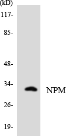 NPM1 / NPM / Nucleophosmin Antibody - Western blot analysis of the lysates from HT-29 cells using NPM antibody.