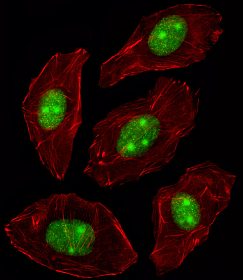 NPM1 / NPM / Nucleophosmin Antibody - Fluorescent image of A549 cell stained with NPM1 Antibody. A549 cells were fixed with 4% PFA (20 min), permeabilized with Triton X-100 (0.1%, 10 min), then incubated with NPM1 primary antibody (1:25, 1 h at 37°C). For secondary antibody, Alexa Fluor 488 conjugated donkey anti-rabbit antibody (green) was used (1:400, 50 min at 37°C). Cytoplasmic actin was counterstained with Alexa Fluor 555 (red) conjugated Phalloidin (7units/ml, 1 h at 37°C). NPM1 immunoreactivity is localized to Nucleus and Nucleolus significantly.