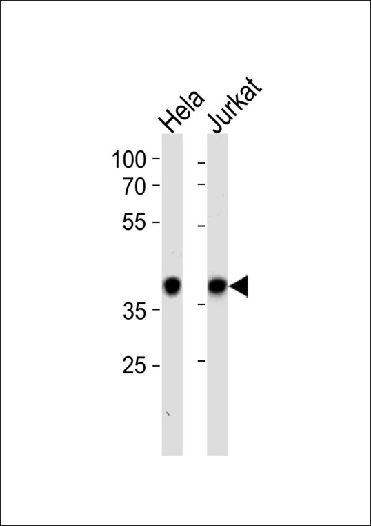 NPM1 / NPM / Nucleophosmin Antibody - NPM1 Antibody western blot of HeLa,Jurkat cell line lysates (35 ug/lane). The NPM1 antibody detected the NPM1 protein (arrow).