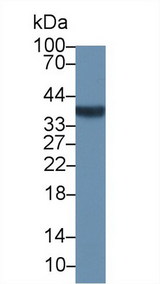 NPM1 / NPM / Nucleophosmin Antibody - Western Blot; Sample: Human Jurkat cell lysate; Primary Ab: 1µg/ml Rabbit Anti-Human NPM Antibody Second Ab: 0.2µg/mL HRP-Linked Caprine Anti-Rabbit IgG Polyclonal Antibody