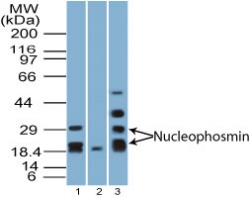 NPM1 / NPM / Nucleophosmin Antibody - Western blot of Nucleophosmin in human spleen tissue lysate in the 1) absence, 2) presence of immunizing peptide and 3) mouse spleen using Polyclonal Antibody to Nucleophosmin at 5 and 2 ug/ml, respectively. Goat anti-rabbit Ig HRP secondary antibody, and PicoTect ECL substrate solution were used for this test.
