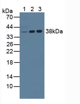 NPM1 / NPM / Nucleophosmin Antibody - Western Blot; Lane1: Mouse Liver Tissue; Lane2: Human Jurkat Cells; Lane3: Human K562 Cells.