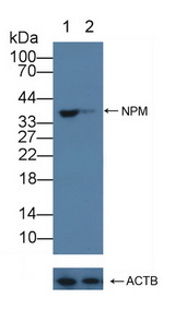NPM1 / NPM / Nucleophosmin Antibody - Knockout Varification: Lane 1: Wild-type Jurkat cell lysate; Lane 2: NPM knockout Jurkat cell lysate; Predicted MW: 33kd Observed MW: 38kd Primary Ab: 1µg/ml Rabbit Anti-Mouse NPM Antibody Second Ab: 0.2µg/mL HRP-Linked Caprine Anti-Rabbit IgG Polyclonal Antibody
