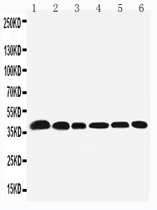 NPM1 / NPM / Nucleophosmin Antibody - WB of NPM1 / NPM / Nucleophosmin antibody. Lane 1: Rat Testis Tissue Lysate. Lane 2: Rat Brain Tissue Lysate. Lane 3: HELA Cell Lysate. Lane 4: U87 Cell Lysate. Lane 5: A549 Cell Lysate. Lane 6: SMMC Cell Lysate.
