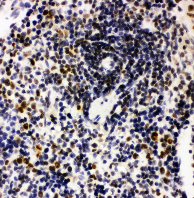 NPM1 / NPM / Nucleophosmin Antibody - NPM1 / NPM / Nucleophosmin antibody. IHC(P): Rat Spleen Tissue.