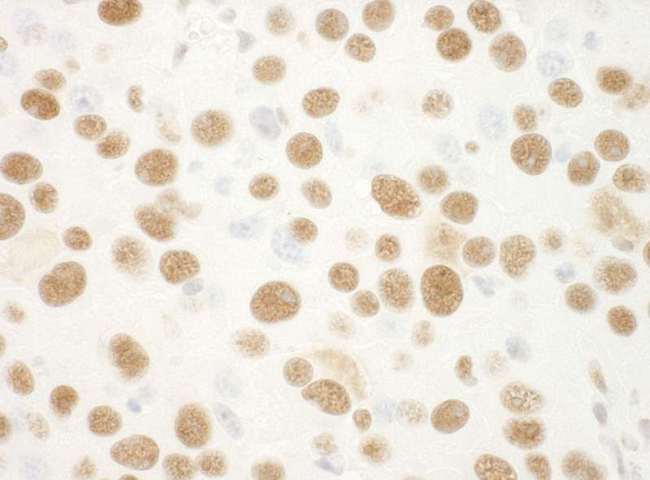 NPM1 / NPM / Nucleophosmin Antibody - Detection of Mouse NPM1 by Immunohistochemistry. Sample: FFPE section of mouse renal cell carcinoma. Antibody: Affinity purified rabbit anti-NPM1 used at a dilution of 1:100.