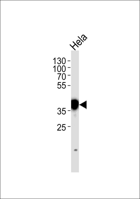 NPM1 / NPM / Nucleophosmin Antibody - NPM1 Antibody western blot of HeLa cell line lysates (35 ug/lane). The NPM1 antibody detected the NPM1 protein (arrow).