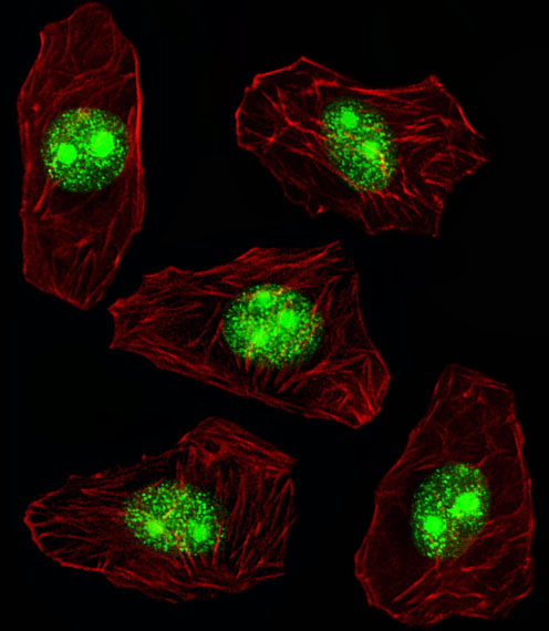 NPM1 / NPM / Nucleophosmin Antibody - Fluorescent image of A549 cell stained with NPM1 Antibody. A549 cells were fixed with 4% PFA (20 min), permeabilized with Triton X-100 (0.1%, 10 min), then incubated with NPM1 primary antibody (1:25, 1 h at 37°C). For secondary antibody, Alexa Fluor 488 conjugated donkey anti-rabbit antibody (green) was used (1:400, 50 min at 37°C). Cytoplasmic actin was counterstained with Alexa Fluor 555 (red) conjugated Phalloidin (7units/ml, 1 h at 37°C). NPM1 immunoreactivity is localized to Nucleus and Nucleolus significantly.