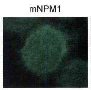 NPM1 / NPM / Nucleophosmin Antibody - Detection of mutant nucleophosmin in OCI-AML3 lysates.  This image was taken for the unconjugated form of this product. Other forms have not been tested.
