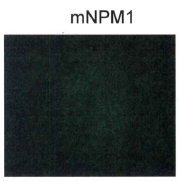 NPM1 / NPM / Nucleophosmin Antibody - Detection of mutant nucleophosmin in OCI-AML3 lysates.  This image was taken for the unconjugated form of this product. Other forms have not been tested.