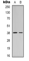 NPM1 / NPM / Nucleophosmin Antibody - Western blot analysis of Nucleophosmin expression in COLO205 (A); NIH3T3 (B) whole cell lysates.
