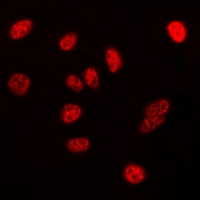 NPM1 / NPM / Nucleophosmin Antibody - Immunofluorescent analysis of Nucleophosmin staining in HeLa cells. Formalin-fixed cells were permeabilized with 0.1% Triton X-100 in TBS for 5-10 minutes and blocked with 3% BSA-PBS for 30 minutes at room temperature. Cells were probed with the primary antibody in 3% BSA-PBS and incubated overnight at 4 deg C in a humidified chamber. Cells were washed with PBST and incubated with a DyLight 594-conjugated secondary antibody (red) in PBS at room temperature in the dark. DAPI was used to stain the cell nuclei (blue).