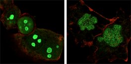 NPM1 / NPM / Nucleophosmin Antibody - Confocal immunofluorescence of HeLa (left) and NTERA-2 (right) cells using NPM mouse mAb (green). Red: Actin filaments have been labeled with DY-554 phalloidin.