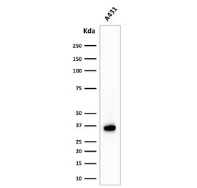 NPM1 / NPM / Nucleophosmin Antibody - Western blot testing of human A431 cell lysate with Nucleophosmin antibody. Expected molecular weight ~38 kDa.