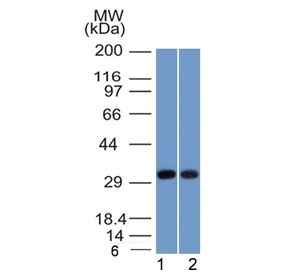 NPM1 / NPM / Nucleophosmin Antibody - Western blot testing of human 1) MCF7 and 2) A431 cell lysate with Nucleophosmin antibody. Expected molecular weight ~38 kDa.