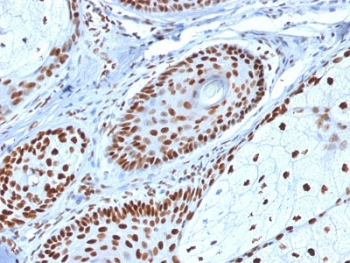 NPM1 / NPM / Nucleophosmin Antibody - IHC staining of FFPE human skin with Nucleophosmin antibody. HIER: boil tissue sections in pH6, 10mM citrate buffer, for 10-20 min and allow to cool before testing.