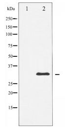 NPM1 / NPM / Nucleophosmin Antibody - Western blot of NPM expression in Jurkat whole cell lysates,The lane on the left is treated with the antigen-specific peptide.