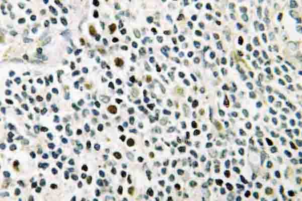 NPM1 / NPM / Nucleophosmin Antibody - IHC of NPM (K230) pAb in paraffin-embedded human tonsil tissue.