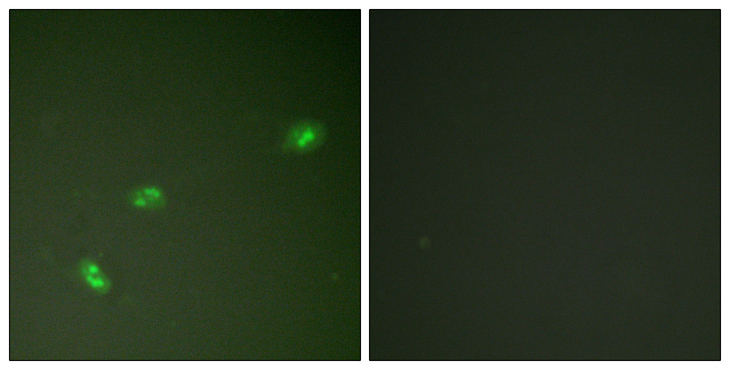 NPM1 / NPM / Nucleophosmin Antibody - Immunofluorescence analysis of HeLa cells treated with EGF 200nM 5', using NPM (Phospho-Thr199) Antibody. The picture on the right is blocked with the phospho peptide.