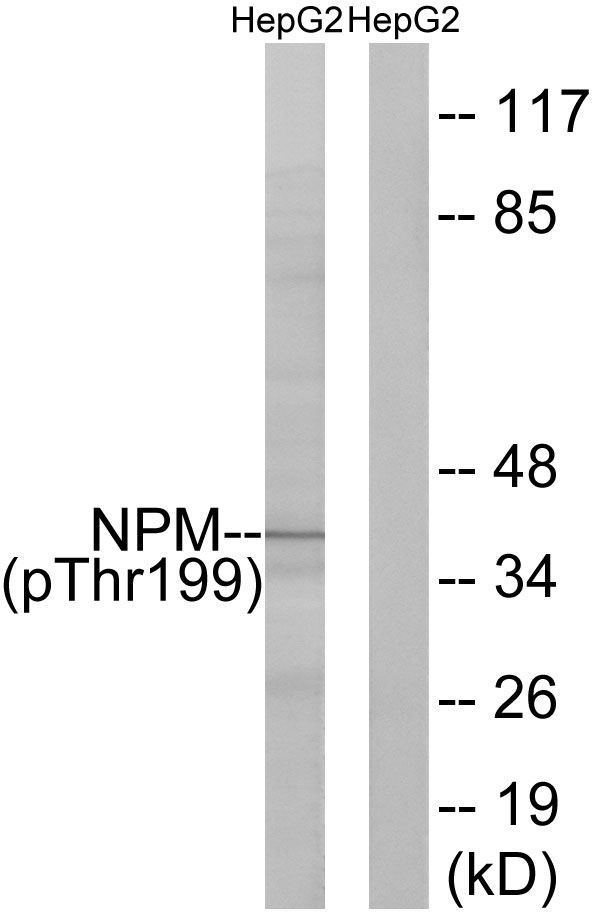 NPM1 / NPM / Nucleophosmin Antibody - Western blot analysis of lysates from HepG2 cells, using NPM (Phospho-Thr199) Antibody. The lane on the right is blocked with the phospho peptide.