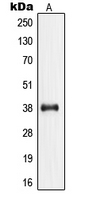 NPM1 / NPM / Nucleophosmin Antibody - Western blot analysis of Nucleophosmin (pT199) expression in HeLa (A) whole cell lysates.