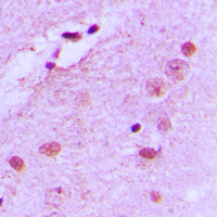 NPM1 / NPM / Nucleophosmin Antibody - Immunohistochemical analysis of Nucleophosmin (pT199) staining in human brain formalin fixed paraffin embedded tissue section. The section was pre-treated using heat mediated antigen retrieval with sodium citrate buffer (pH 6.0). The section was then incubated with the antibody at room temperature and detected using an HRP conjugated compact polymer system. DAB was used as the chromogen. The section was then counterstained with hematoxylin and mounted with DPX.