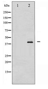 NPM1 / NPM / Nucleophosmin Antibody - Western blot of NPM phosphorylation expression in Jurkat whole cell lysates,The lane on the left is treated with the antigen-specific peptide.