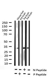 NPM1 / NPM / Nucleophosmin Antibody - Western blot analysis of Phospho-NPM (Thr199) expression in various lysates