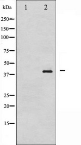 NPM1 / NPM / Nucleophosmin Antibody - Western blot analysis of NPM phosphorylation expression in Jurkat whole cells lysates. The lane on the left is treated with the antigen-specific peptide.