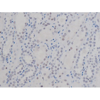 NPM1 / NPM / Nucleophosmin Antibody - 1:200 staining human kidney tissue by IHC-P. The tissue was formaldehyde fixed and a heat mediated antigen retrieval step in citrate buffer was performed. The tissue was then blocked and incubated with the antibody for 1.5 hours at 22°C. An HRP conjugated goat anti-rabbit antibody was used as the secondary.