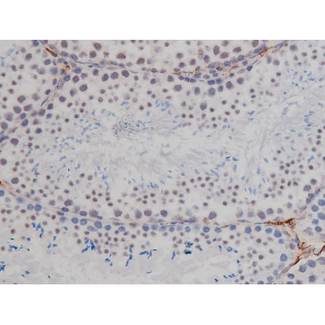 NPM1 / NPM / Nucleophosmin Antibody - 1:200 staining mouse testis tissue by IHC-P. The tissue was formaldehyde fixed and a heat mediated antigen retrieval step in citrate buffer was performed. The tissue was then blocked and incubated with the antibody for 1.5 hours at 22°C. An HRP conjugated goat anti-rabbit antibody was used as the secondary.