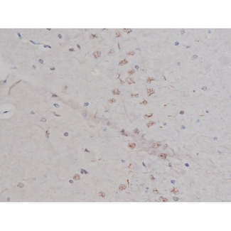 NPM1 / NPM / Nucleophosmin Antibody - 1:200 staining rat brain tissue by IHC-P. The tissue was formaldehyde fixed and a heat mediated antigen retrieval step in citrate buffer was performed. The tissue was then blocked and incubated with the antibody for 1.5 hours at 22°C. An HRP conjugated goat anti-rabbit antibody was used as the secondary.
