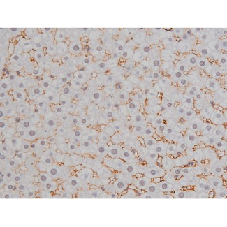 NPM1 / NPM / Nucleophosmin Antibody - 1:200 staining rat liver tissue by IHC-P. The tissue was formaldehyde fixed and a heat mediated antigen retrieval step in citrate buffer was performed. The tissue was then blocked and incubated with the antibody for 1.5 hours at 22°C. An HRP conjugated goat anti-rabbit antibody was used as the secondary.