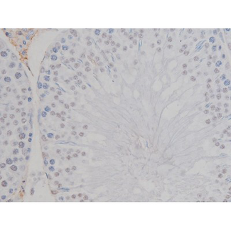 NPM1 / NPM / Nucleophosmin Antibody - 1:200 staining rat testis tissue by IHC-P. The tissue was formaldehyde fixed and a heat mediated antigen retrieval step in citrate buffer was performed. The tissue was then blocked and incubated with the antibody for 1.5 hours at 22°C. An HRP conjugated goat anti-rabbit antibody was used as the secondary.