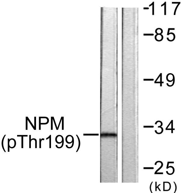 NPM1 / NPM / Nucleophosmin Antibody - Western blot analysis of extracts from Jurkat cells, using NPM (Phospho-Thr199) antibody.