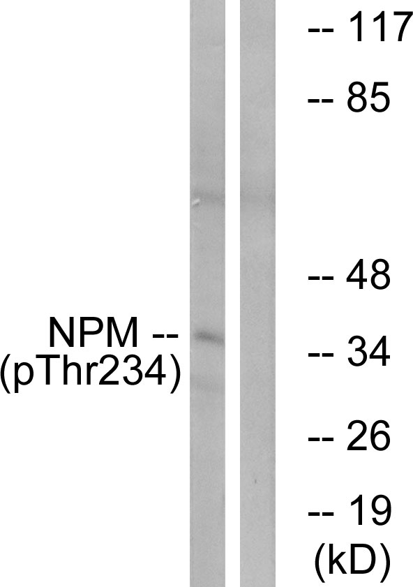 NPM1 / NPM / Nucleophosmin Antibody - Western blot analysis of lysates from HeLa cells treated with nocodazole 1ug/ml 18h, using NPM (Phospho-Thr234) Antibody. The lane on the right is blocked with the phospho peptide.