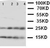 NPM2 Antibody - WB of NPM2 antibody. Lane 1: HELA Cell Lysate. Lane 2: U87 Cell Lysate. Lane 3: A549 Cell Lysate. Lane 4: SMMC Cell Lysate.