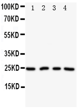 NPM2 Antibody - Anti-NPM2 antibody, Western blotting Lane 1: HELA Cell LysateLane 2: U87 Cell LysateLane 3: A549 Cell LysateLane 4: SMMC Cell Lysate