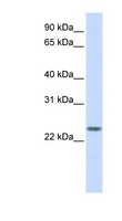 NPM2 Antibody - NPM2 antibody Western blot of Placenta lysate. This image was taken for the unconjugated form of this product. Other forms have not been tested.