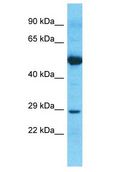 NPM2 Antibody - NPM2 antibody Western Blot of Thymus Tumor. Antibody dilution: 1 ug/ml.  This image was taken for the unconjugated form of this product. Other forms have not been tested.
