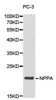 NPPA / ANP Antibody - Western blot of extracts of PC-3 cell lines, using NPPA antibody.