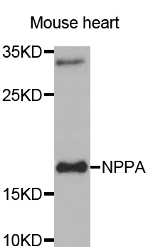 NPPA / ANP Antibody - Western blot analysis of extracts of Mouse heart tissue.
