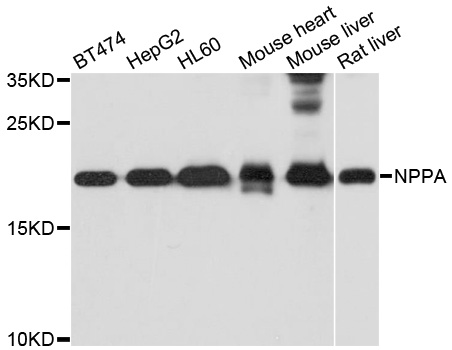 NPPA / ANP Antibody - Western blot analysis of extracts of various cell lines, using NPPA antibody at 1:1000 dilution. The secondary antibody used was an HRP Goat Anti-Rabbit IgG (H+L) at 1:10000 dilution. Lysates were loaded 25ug per lane and 3% nonfat dry milk in TBST was used for blocking. An ECL Kit was used for detection and the exposure time was 1s.