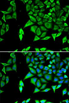 NPPA / ANP Antibody - Immunofluorescence analysis of U2OS cells using NPPA antibody. Blue: DAPI for nuclear staining.